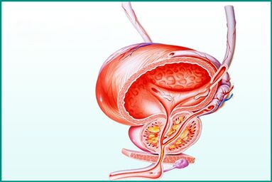 Ang panghubag sa prostate sa acute prostatitis usa ka limitasyon sa sekso